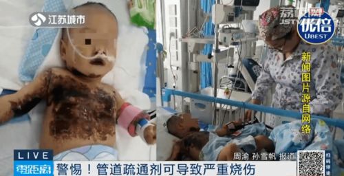 管道疏通剂被灼伤会怎么样(管道疏通剂被灼伤会怎么样吗) 管道疏通剂被灼伤会怎么样(管道疏通剂被灼伤会怎么样吗)