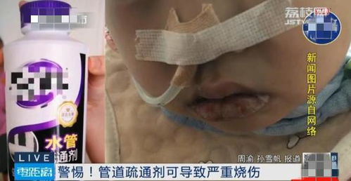 管道疏通剂小孩误食怎么办(管道疏通剂小孩吃了有生命危险吗) 管道疏通剂小孩误食怎么办(管道疏通剂小孩吃了有生命危险吗)
