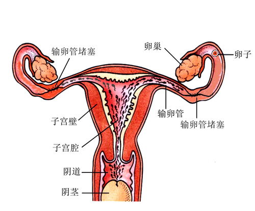 管道疏通淋巴堵塞怎么办(淋巴管堵了)