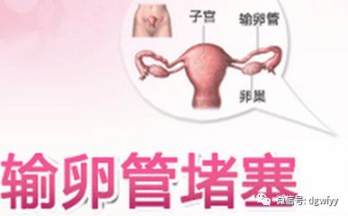 输卵管道粘连怎么疏通(输卵管黏连怎么疏通)