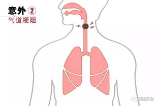 怎么自我疏通支气管道堵塞(怎么自我疏通支气管道堵塞的方法)