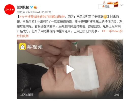 管道疏通灼伤皮肤了怎么处理(管道疏通剂触碰皮肤以后怎么处理) 管道疏通灼伤皮肤了怎么处理(管道疏通剂触碰皮肤以后怎么处理)