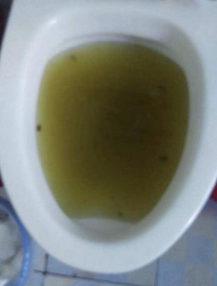 管道疏通剂盖子怎么用(管道疏通液瓶盖怎么打开) 管道疏通剂盖子怎么用(管道疏通液瓶盖怎么打开)