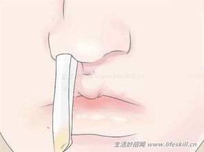怎么疏通鼻窦口腔管道呢(鼻窦口堵塞怎么打开)