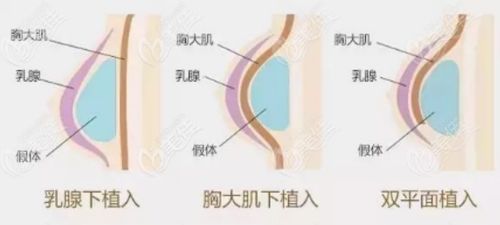产前怎么疏通乳腺管道呢(产前乳房疏通)