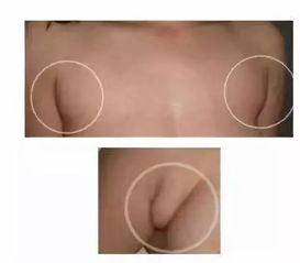怎么可以疏通乳腺管道(怎么可以疏通乳腺管道的方法)